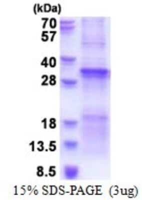 SDS-Page: TGFBRAP1 Recombinant Protein [NBP2-51602] - 15% SDS Page (3 ug)