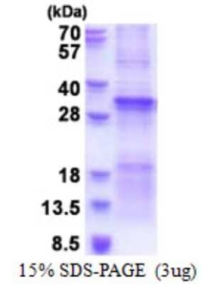 SDS-PAGE Recombinant Human TGFBRAP1 His Protein