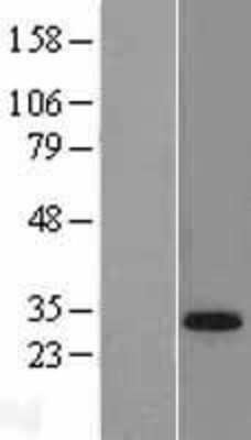 Western Blot: TGIF Overexpression Lysate (Adult Normal) [NBP2-05146] Left-Empty vector transfected control cell lysate (HEK293 cell lysate); Right -Over-expression Lysate for TGIF.