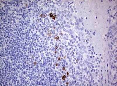 Immunohistochemistry: TGIF1 Antibody (OTI1B12) - Azide and BSA Free [NBP2-74496] - Analysis of Human tonsil tissue. (Heat-induced epitope retrieval by 10mM citric buffer, pH6.0, 120C for 3min)