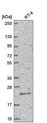 <b>Orthogonal Strategies Validation. </b>Western Blot: TGIF1 Antibody [NBP2-55829] - Analysis in human cell line RT-4.