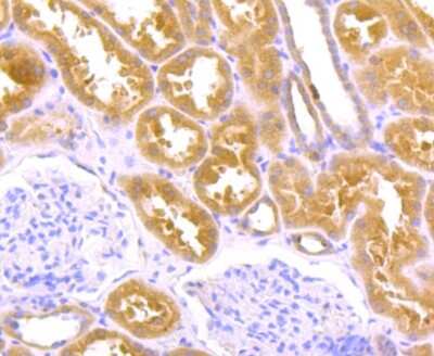 Immunohistochemistry-Paraffin: TGM6 Antibody [NBP2-75688] - Analysis of paraffin-embedded human kidney tissue using anti-TGM6 antibody. Counter stained with hematoxylin.