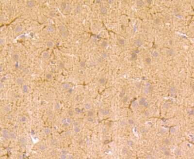 Immunohistochemistry-Paraffin: TGM6 Antibody [NBP2-75688] - Analysis of paraffin-embedded rat brain tissue using anti-TGM6 antibody. Counter stained with hematoxylin.