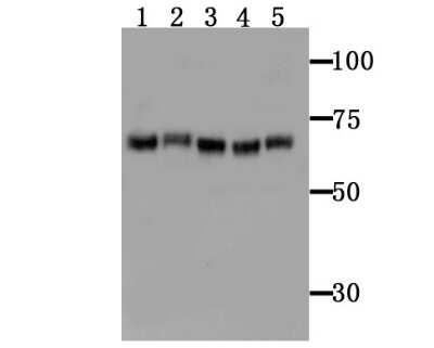 Western Blot: TGM6 Antibody [NBP2-75688] - Analysis of TGM6 on different tissue lysates using anti-TGM6 antibody at 1/100 dilution.Positive control:Lane 1 : Mouse brain      Lane 2 : Mouse brainLane 3 : Mouse spleen     Lane 4 : Mouse spleenLane 5 : Mouse testis