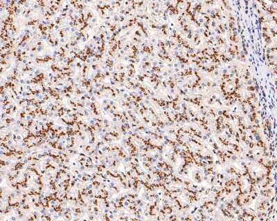 Immunohistochemistry-Paraffin: TGN38 Antibody (JF1-024) [NBP2-67193] - Analysis of paraffin-embedded human liver tissue using anti-TGN38 antibody. The section was pre-treated using heat mediated antigen retrieval with Tris-EDTA buffer (pH 9.0) for 20 minutes.The tissues were blocked in 1% BSA for 30 minutes at room temperature, washed with ddH2O and PBS, and then probed with the primary antibody (1/100) for 30 minutes at room temperature. The detection was performed using an HRP conjugated compact polymer system. DAB was used as the chromogen. Tissues were counterstained with hematoxylin and mounted with DPX.