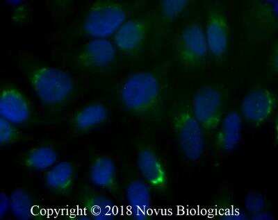 Immunocytochemistry/Immunofluorescence: TGN46 Antibody [Alexa Fluor® 488] [NBP1-49643AF488] - HeLa cells were fixed for 10 minutes using 10% formalin and then permeabilized for 5 minutes using 1X PBS + 0.05% Triton X-100.  The cells were incubated with anti-TGN46 conjugated to Alexa Fluor 488 [NBP1-49643AF488] at 10ug/ml for 1 hour at room temperature.  Nuclei were counterstained with DAPI (Blue).  Cells were imaged using a 40X objective.