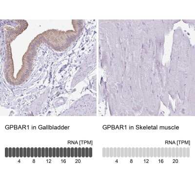 <b>Orthogonal Strategies Validation. </b>Immunohistochemistry-Paraffin: TGR5/GPBAR1 Antibody [NBP2-49376] - Analysis in human gallbladder and skeletal muscle tissues. Corresponding TGR5/GPBAR1 RNA-seq data are presented for the same tissues.