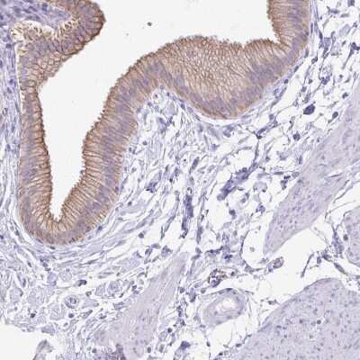 Immunohistochemistry-Paraffin: TGR5/GPBAR1 Antibody [NBP2-49376] - Staining of human gallbladder shows  moderate membranous positivity in glandular cells.