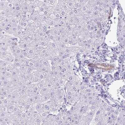 Immunohistochemistry-Paraffin: TGR5/GPBAR1 Antibody [NBP2-49376] - Staining of human liver shows no  positivity in hepatocytes as expected.