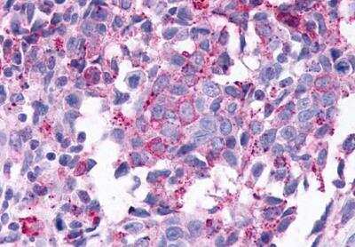 Immunohistochemistry-Paraffin TGR5/GPBAR1 Antibody - BSA Free