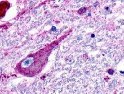 Immunohistochemistry-Paraffin: TGR5/GPBAR1 Antibody [NLS401] - TGR5 Antibody [NLS401] - IHC analysis of Brain, Neuron using NLS401 at 2 ug/ ml.