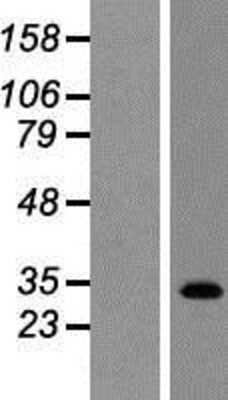 Western Blot TGR5/GPBAR1 Overexpression Lysate