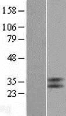 Western Blot TGR5/GPBAR1 Overexpression Lysate