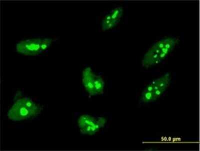 Immunocytochemistry/Immunofluorescence: THAP1 Antibody (2C1-2F2) [H00055145-M01] - Analysis of monoclonal antibody to THAP1 on HeLa cell . Antibody concentration 10 ug/ml.