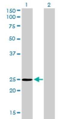 Western Blot: THAP1 Antibody (2C1-2F2) [H00055145-M01] - Analysis of THAP1 expression in transfected 293T cell line by THAP1 monoclonal antibody (M01), clone 2C1-2F2.Lane 1: THAP1 transfected lysate(24.9 KDa).Lane 2: Non-transfected lysate.