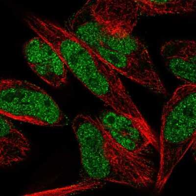 Immunocytochemistry/Immunofluorescence: THAP1 Antibody [NBP2-56308] - Staining of human cell line RH-30 shows localization to nucleoplasm & vesicles.