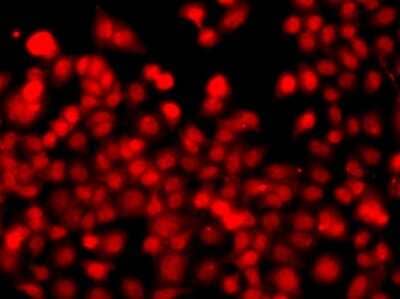 Immunocytochemistry/Immunofluorescence: THAP1 Antibody [NBP2-93163] - Analysis of A549 cells using THAP1 .