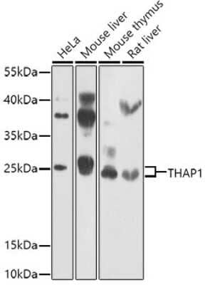 Western Blot: THAP1 Antibody [NBP2-93163] - Analysis of extracts of various cell lines, using THAP1 antibody at 1:1000 dilution.Secondary antibody: HRP Goat Anti-Rabbit IgG (H+L) at 1:10000 dilution.Lysates/proteins: 25ug per lane. Blocking buffer: 3% nonfat dry milk in TBST.Detection: ECL Enhanced Kit. Exposure time: 30s.