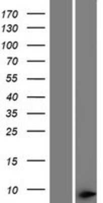 Western Blot: THAP1 Overexpression Lysate (Adult Normal) [NBP2-10089] Left-Empty vector transfected control cell lysate (HEK293 cell lysate); Right -Over-expression Lysate for THAP1.