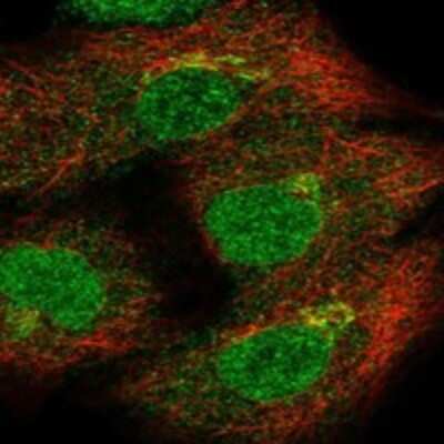 Immunocytochemistry/Immunofluorescence: THAP10 Antibody [NBP3-17547] - Staining of human cell line A549 shows localization to nucleoplasm, cytosol & the Golgi apparatus.