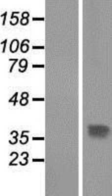 Western Blot: THAP10 Overexpression Lysate (Adult Normal) [NBP2-06665] Left-Empty vector transfected control cell lysate (HEK293 cell lysate); Right -Over-expression Lysate for THAP10.