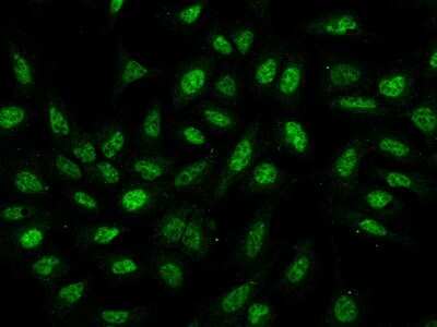 Immunocytochemistry/Immunofluorescence: THAP11 Antibody [NBP2-97155] - Immunofluorescence staining of THAP11 in U2OS cells. Cells were fixed with 4% PFA, permeabilzed with 0.1% Triton X-100 in PBS, blocked with 10% serum, and incubated with rabbit anti-Human THAP11 polyclonal antibody (dilution ratio 1:200) at 4C overnight. Then cells were stained with the Alexa Fluor(R)488-conjugated Goat Anti-rabbit IgG secondary antibody (green). Positive staining was localized to Nucleus.