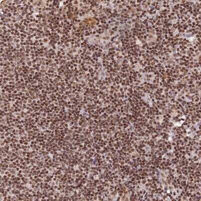 Immunohistochemistry-Paraffin: THAP11 Antibody [NBP1-92494] - Staining of human lymph node shows strong nuclear positivity in non-germinal center cells.