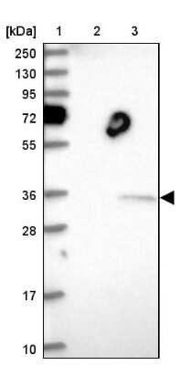 Western Blot: THAP11 Antibody [NBP1-92495] - Lane 1: Marker [kDa] 250, 130, 95, 72, 55, 36, 28, 17, 10Lane 2: Human cell line RT-4Lane 3: Human cell line U-251MG sp