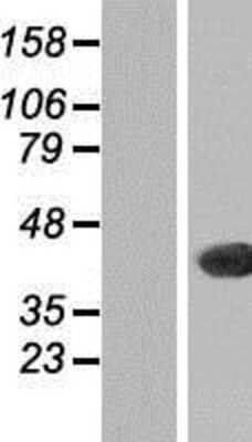 Western Blot: THAP11 Overexpression Lysate (Adult Normal) [NBP2-06641] Left-Empty vector transfected control cell lysate (HEK293 cell lysate); Right -Over-expression Lysate for THAP11.
