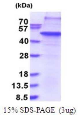 SDS-PAGE Recombinant Human THAP11 His Protein