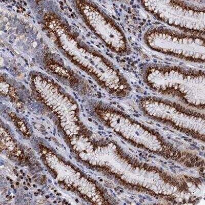 Immunohistochemistry-Paraffin: THAP2 Antibody [NBP1-84157] - Staining of human stomach, upper shows strong granular cytoplasmic positivity in glandular cells.