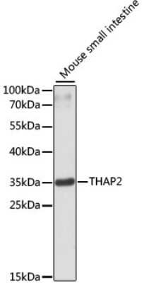 Western Blot: THAP2 Antibody [NBP2-94861] - Analysis of extracts of mouse small intestine, using THAP2 at 1:3000 dilution.Secondary antibody: HRP Goat Anti-Rabbit IgG (H+L) at 1:10000 dilution.Lysates/proteins: 25ug per lane.Blocking buffer: 3% nonfat dry milk in TBST.Detection: ECL Basic Kit .Exposure time: 90s.