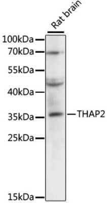 Western Blot: THAP2 Antibody [NBP2-94861] - Analysis of extracts of rat brain, using THAP2 .Exposure time: 5s.