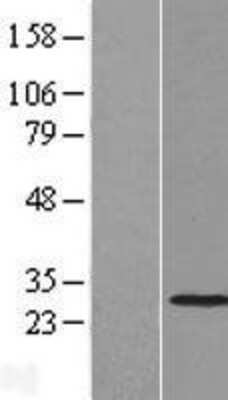 Western Blot: THAP2 Overexpression Lysate (Adult Normal) [NBL1-16873] Left-Empty vector transfected control cell lysate (HEK293 cell lysate); Right -Over-expression Lysate for THAP2.