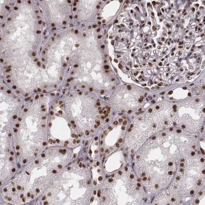 Immunohistochemistry-Paraffin: THAP3 Antibody [NBP2-57825] - Immunohistochemical staining of human kidney shows nuclear positivity in cells in tubules and cells in glomeruli.