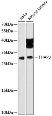 Western Blot: THAP3 Antibody [NBP2-93451] - Analysis of extracts of various cell lines, using THAP3 . Exposure time: 90s.
