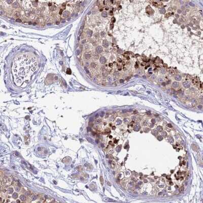 Immunohistochemistry-Paraffin: THAP5 Antibody [NBP1-92497] - Staining of human testis shows strong cytoplasmic positivity in cells in seminiferous ducts.