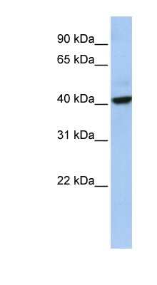 Western Blot: THAP5 Antibody [NBP1-56750] - Human Placenta lysate, concentration 0.2-1 ug/ml.