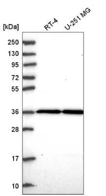 Western Blot THAP5 Antibody - BSA Free
