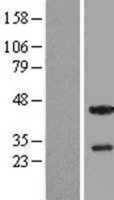Western Blot: THAP5 Overexpression Lysate (Adult Normal) [NBL1-16874] Left-Empty vector transfected control cell lysate (HEK293 cell lysate); Right -Over-expression Lysate for THAP5.