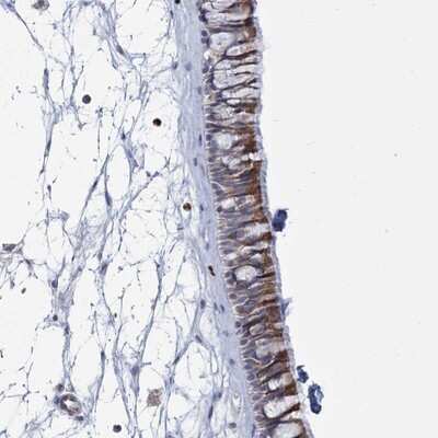 Immunohistochemistry-Paraffin: THAP6 Antibody [NBP1-81130] - Staining of human nasopharynx shows moderate cytoplasmic positivity in respiratory epithelial cells.