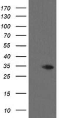 Western Blot: THAP6 Antibody (OTI1E10) - Azide and BSA Free [NBP2-74498] - Analysis of HEK293T cells were transfected with the pCMV6-ENTRY control (Left lane) or pCMV6-ENTRY THAP6.