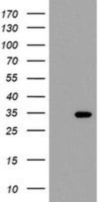 Western Blot: THAP6 Antibody (OTI1F6) - Azide and BSA Free [NBP2-74497] - HEK293T cells were transfected with the pCMV6-ENTRY control (Left lane) or pCMV6-ENTRY THAP6 (Right lane) cDNA for 48 hrs and lysed. Equivalent amounts of cell lysates (5 ug per lane) were separated by SDS-PAGE and immunoblotted with anti-THAP6.