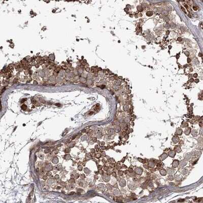 Immunohistochemistry-Paraffin: THAP9 Antibody [NBP1-93848] - Staining of human testis shows distinct cytoplasmic in cells in seminiferous ducts.