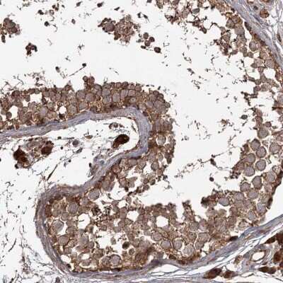 Immunohistochemistry-Paraffin THAP9 Antibody - BSA Free