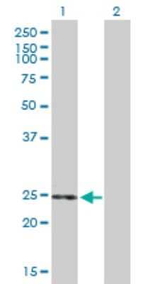 Western Blot THEM5 Antibody