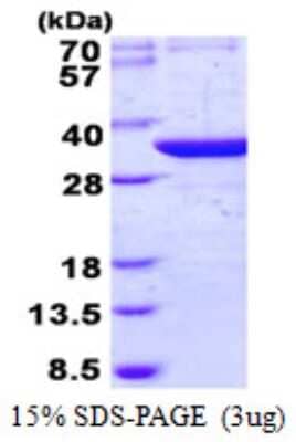 SDS-PAGE Recombinant Human THG1L His Protein