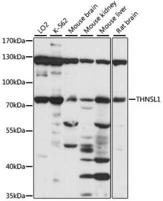 Western Blot: THNSL1 Antibody [NBP2-93147] - Analysis of extracts of various cell lines, using THNSL1 at 1:1000 dilution. Secondary antibody: HRP Goat Anti-Rabbit IgG (H+L) at 1:10000 dilution. Lysates/proteins: 25ug per lane. Blocking buffer: 3% nonfat dry milk in TBST. Detection: ECL Basic Kit . Exposure time: 30s.