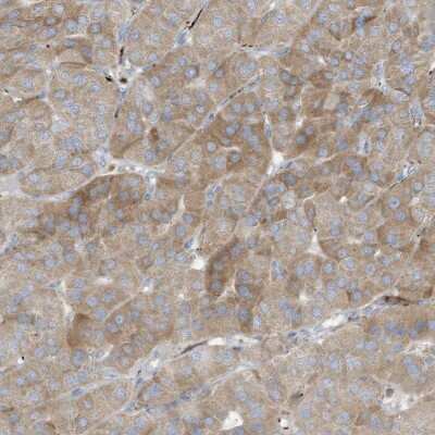 Immunohistochemistry-Paraffin: THNSL2 Antibody [NBP1-83811] - Staining of human parathyroid gland shows moderate positivity in glandular cells.