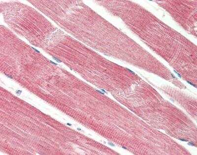 Immunohistochemistry-Paraffin: THNSL2 Antibody [NBP2-26093] - (5ug/ml) staining of paraffin embedded Human Skeletal Muscle. Steamed antigen retrieval with citrate buffer pH 6, AP-staining.